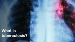 Kussmaul Breathing in Metabolic Acidosis: Meaning, Symptoms, Causes  Treatment Guide