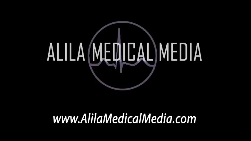 Babinski Sign: How to Elicit, Meaning, Normal vs Abnormal Response